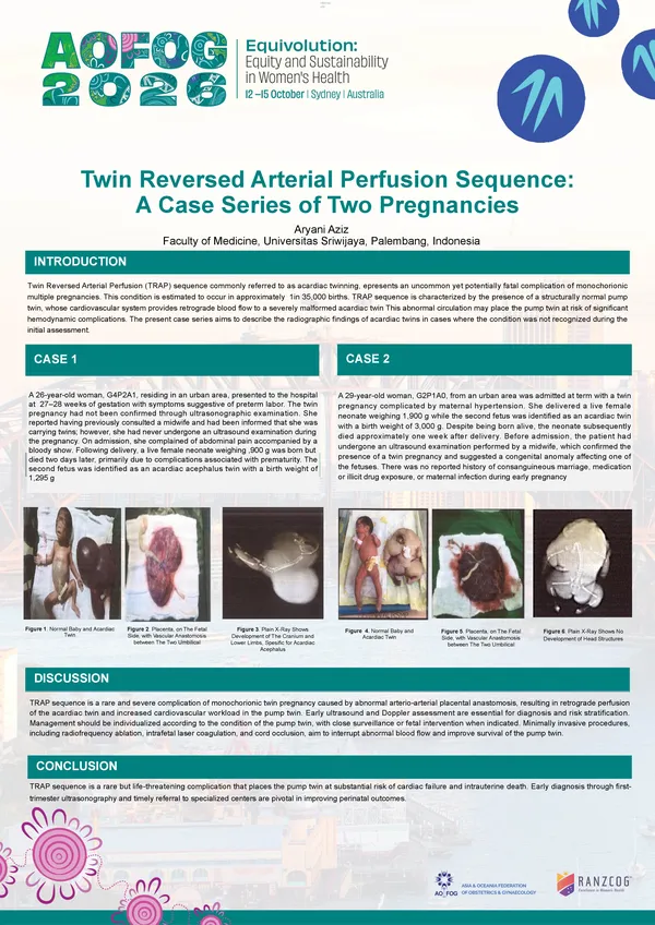 Twin Reversed Arterial Perfusion (TRAP) Sequence: A Case Series of Two Pregnancies
