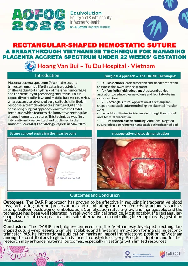 Rectangular-shaped hemostatic suture – a breakthrough Vietnamese technique for managing placenta accreta spectrum under 22 weeks’ gestation