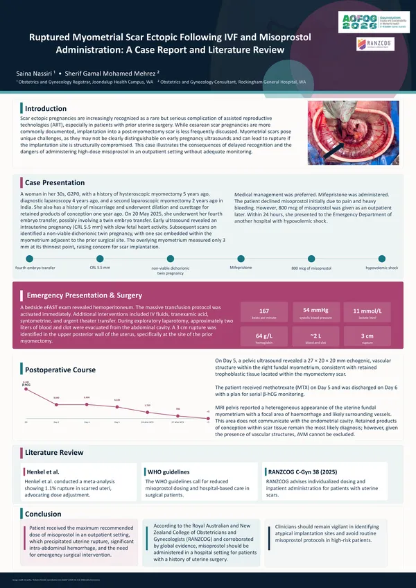 Uterine Rupture from Myometrial Scar Ectopic After IVF: A Case Report Highlighting Misoprostol Associated Risk