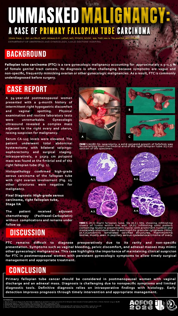 Unmasked malignancy: a case of primary fallopian tube carcinoma