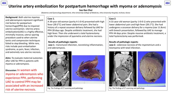 Uterine artery embolization for postpartum hemorrhage with myoma or adenomyosis