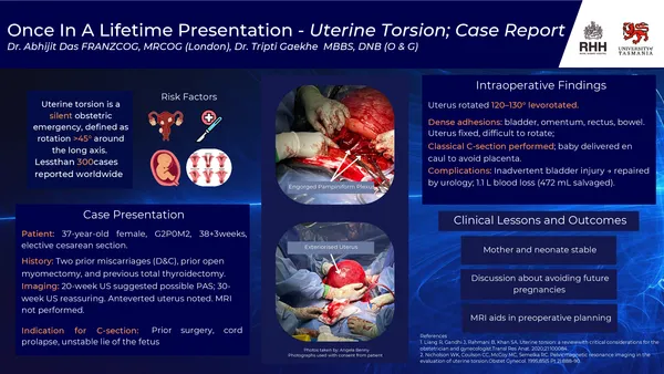 Once in a lifetime presentation – Uterine torsion (120–130° levorotated)