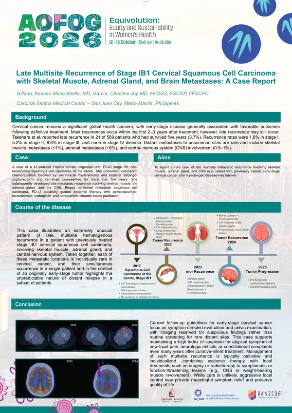 Late Multisite Recurrence of Stage IB1 Cervical Squamous Cell Carcinoma with Skeletal Muscle, Adrenal Gland, and Brain Metastases: A Case Report