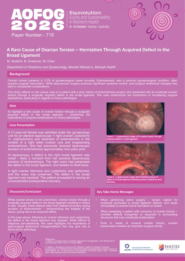 A Rare Cause of Ovarian Torsion – Herniation Through Acquired Defect in the Broad Ligament