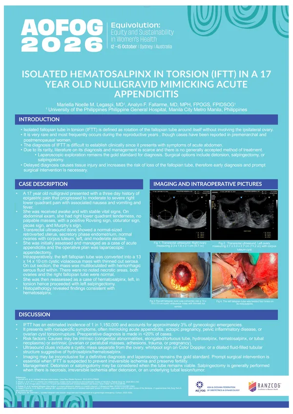 Isolated Hematosalpinx in Torsion in a 17-Year-Old Nulligravid Mimicking Acute Appendicitis