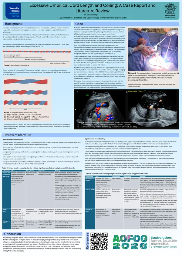 Excessive umbilical cord length and coiling: a case report and literature review