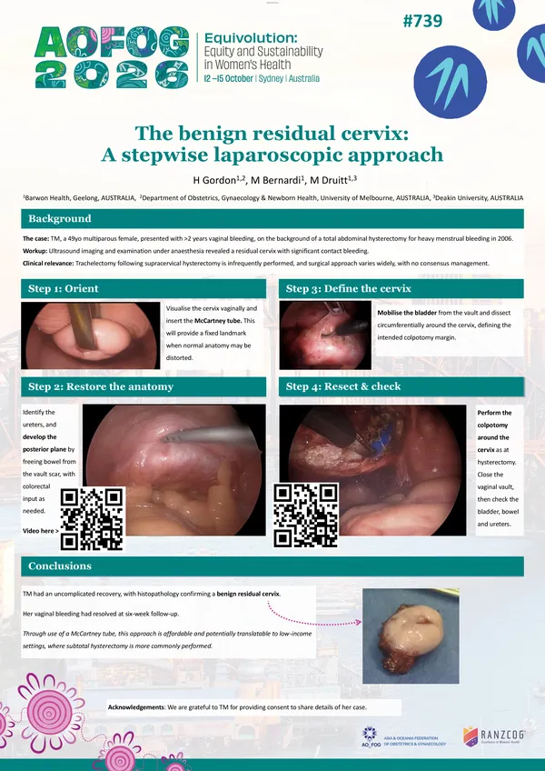 A stepwise laparoscopic approach to excision of the benign residual cervix