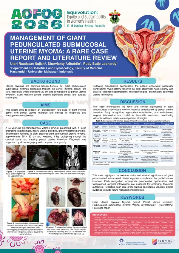 Management of Giant Pedunculated Submucosal Uterine Myoma: A Rare Case Report and Literature Review