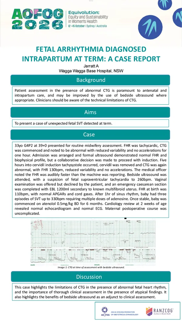 Fetal arrhythmia diagnosed intrapartum at term: A Case Report