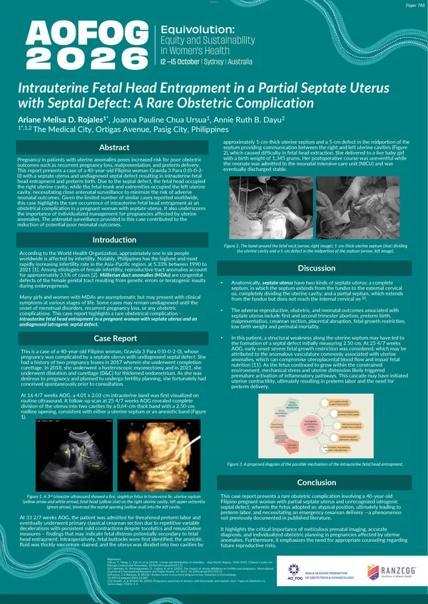 Intrauterine Fetal Head Entrapment in a Partial Septate Uterus with Septal Defect: A Rare Obstetric Complication