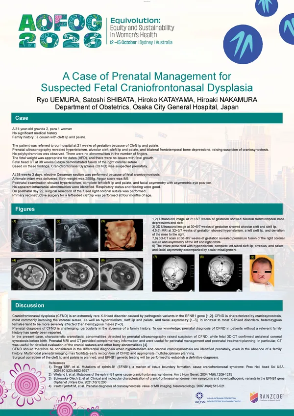 A Case of Prenatal Management for Suspected Fetal Craniofrontonasal Dysplasia