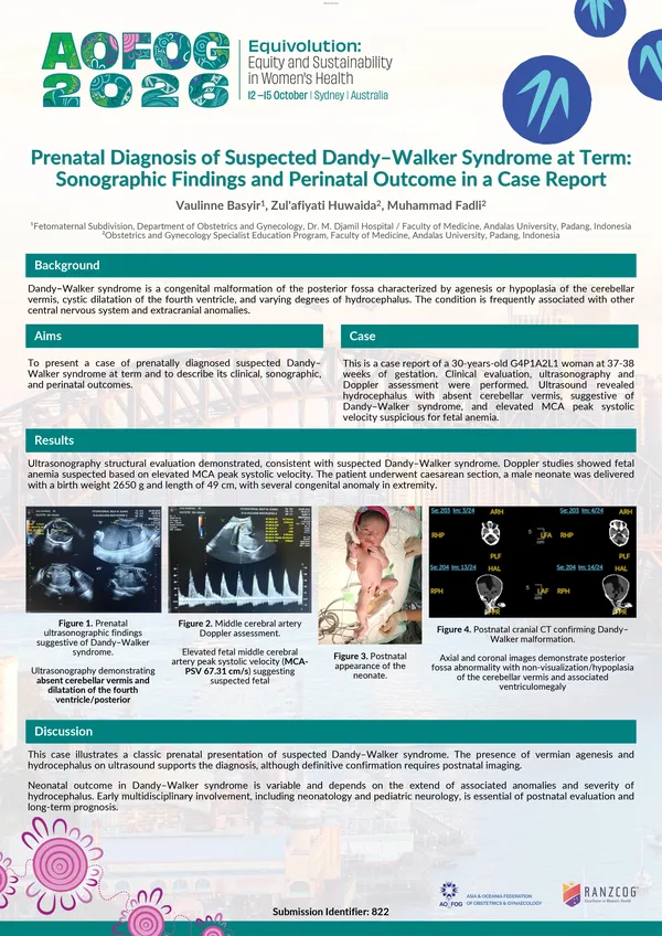 Prenatal Diagnosis of Suspected Dandy–Walker Syndrome at Term: Sonographic Findings and Perinatal Outcome in a Case Report