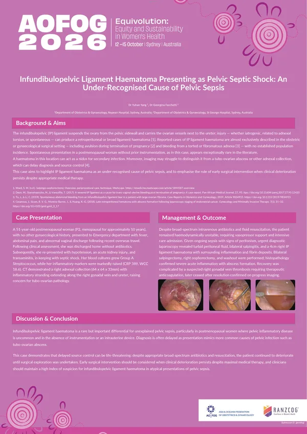Infundibulopelvic Ligament Haematoma Presenting as Pelvic Septic Shock