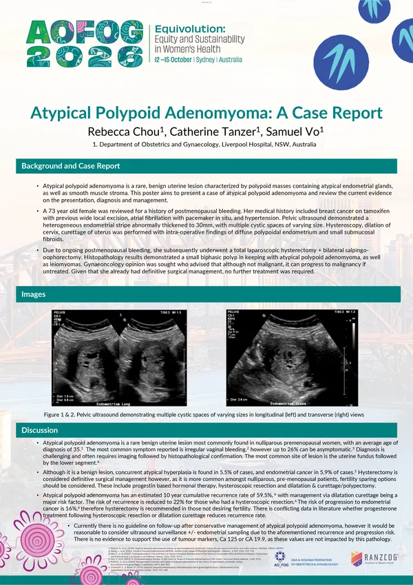 Atypical Polypoid Adenomyoma: A case report