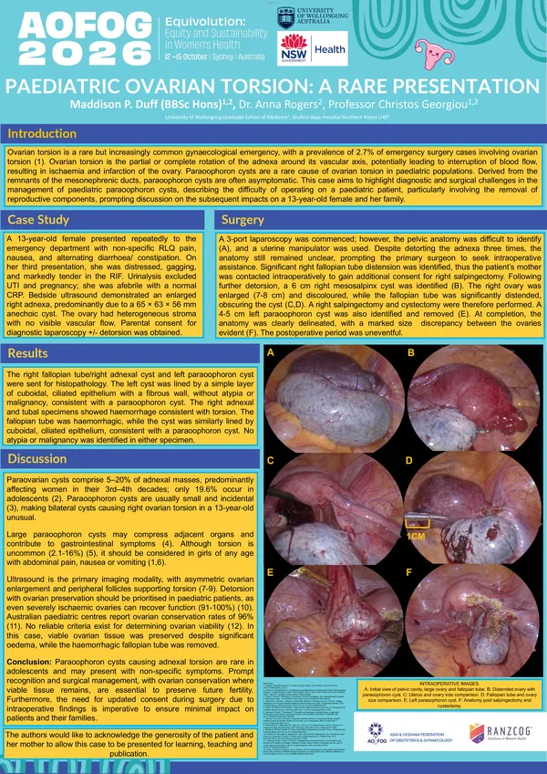 Paediatric ovarian torsion – a rare presentation