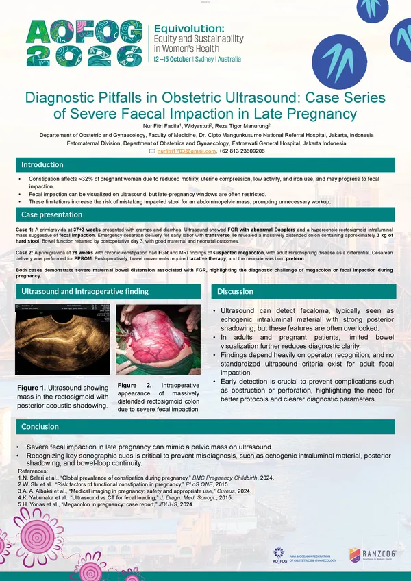 Diagnostic Pitfalls in Obstetric Ultrasound: Case Series of Severe Fecal Impaction in Late Pregnancy