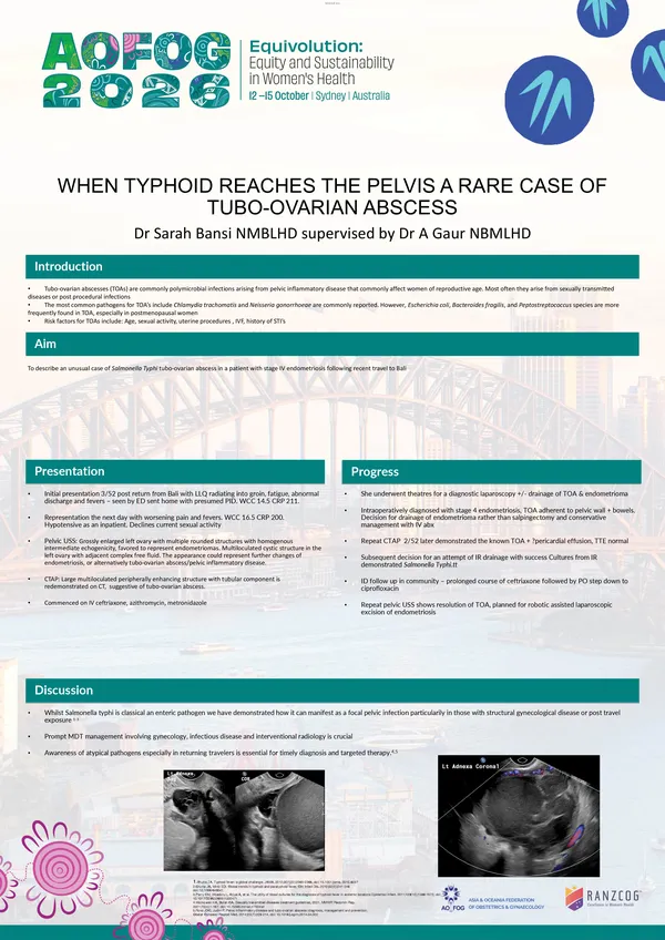 When Typhoid Reaches the Pelvis  A Rare Case of Tubo-Ovarian Abscess
