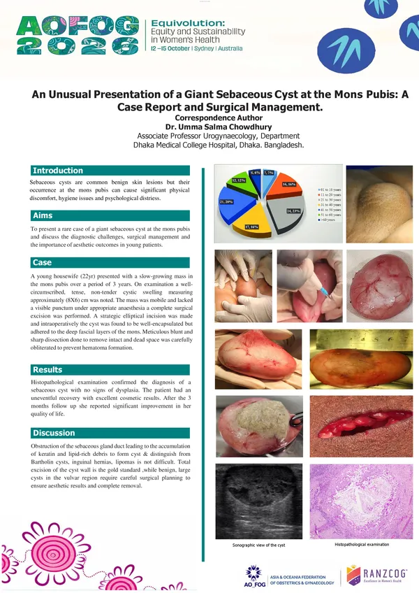 An Unusual Presentation of a Giant Sebaceous Cyst at the Mons Pubis: A Case Report and Surgical Management